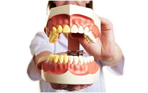 zobu higiД“na